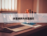 余磊病例与余磊图片