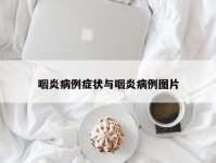 咽炎病例症状与咽炎病例图片