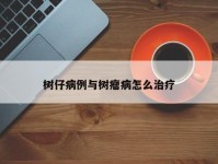 树仔病例与树瘤病怎么治疗