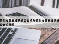 脸脱皮是无症状感染者吗与脸脱皮是无症状感染者吗图片