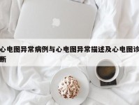 心电图异常病例与心电图异常描述及心电图诊断