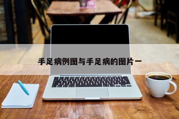 手足病例图与手足病的图片一
